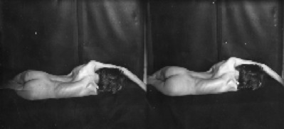 GCP.184
<br/>
Deformity
<br/>
<em></em>